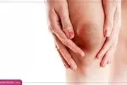 خانم ها این خبرو از دست ندن | درمان خانگی تیرگی زانو در یک هفته