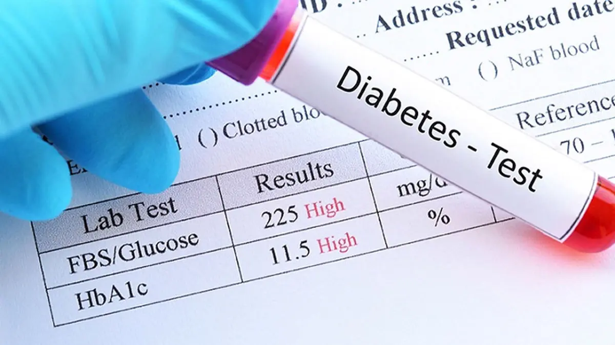 8 آزمایش مهم برای افراد دیابتی و کنترل بهتر شرایط!!!