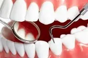 این موادغذایی عامل مهم پوسیدگی دندان است! + ویدئو
