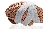 با این کار به درمان خانگی سکته مغزی بپردازید | برای درمان سکته مغزی کدام اقدام بهتر است انجام شود؟